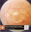 ANALISIS DE LA RETINOPATIA DIABETICA EN PACIENTES QUE ACUDEN A SERVICIOS DE MEDI