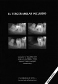 Portada de: El tercer molar incluido